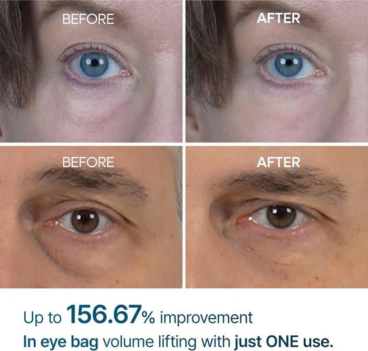 Dr. Melaxin Eyephalt Eye Cream image 2