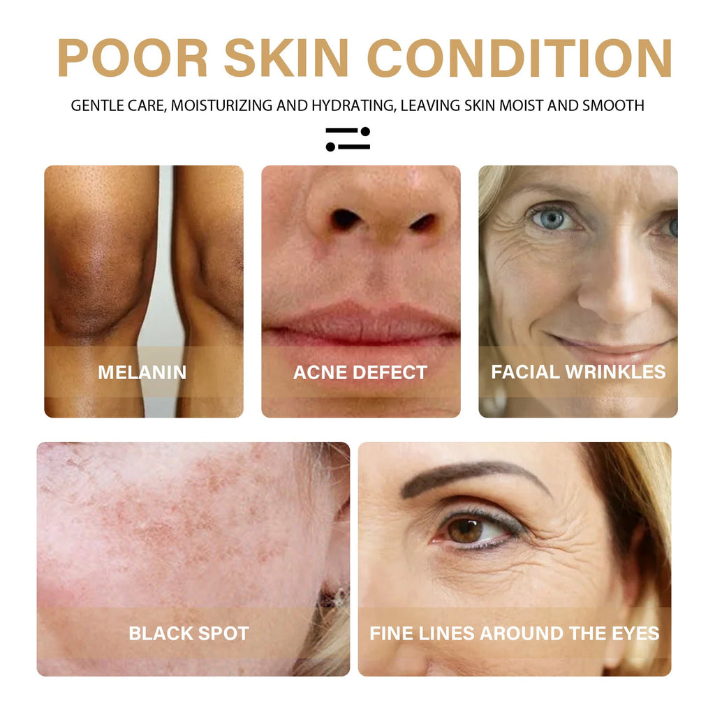 EELHOE Turmeric Dark Spot Correction Face Care Spot Moisturizing And