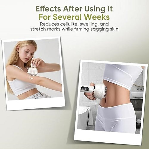 Elysse SculptWave™ Anti-Cellulite Massager image 3