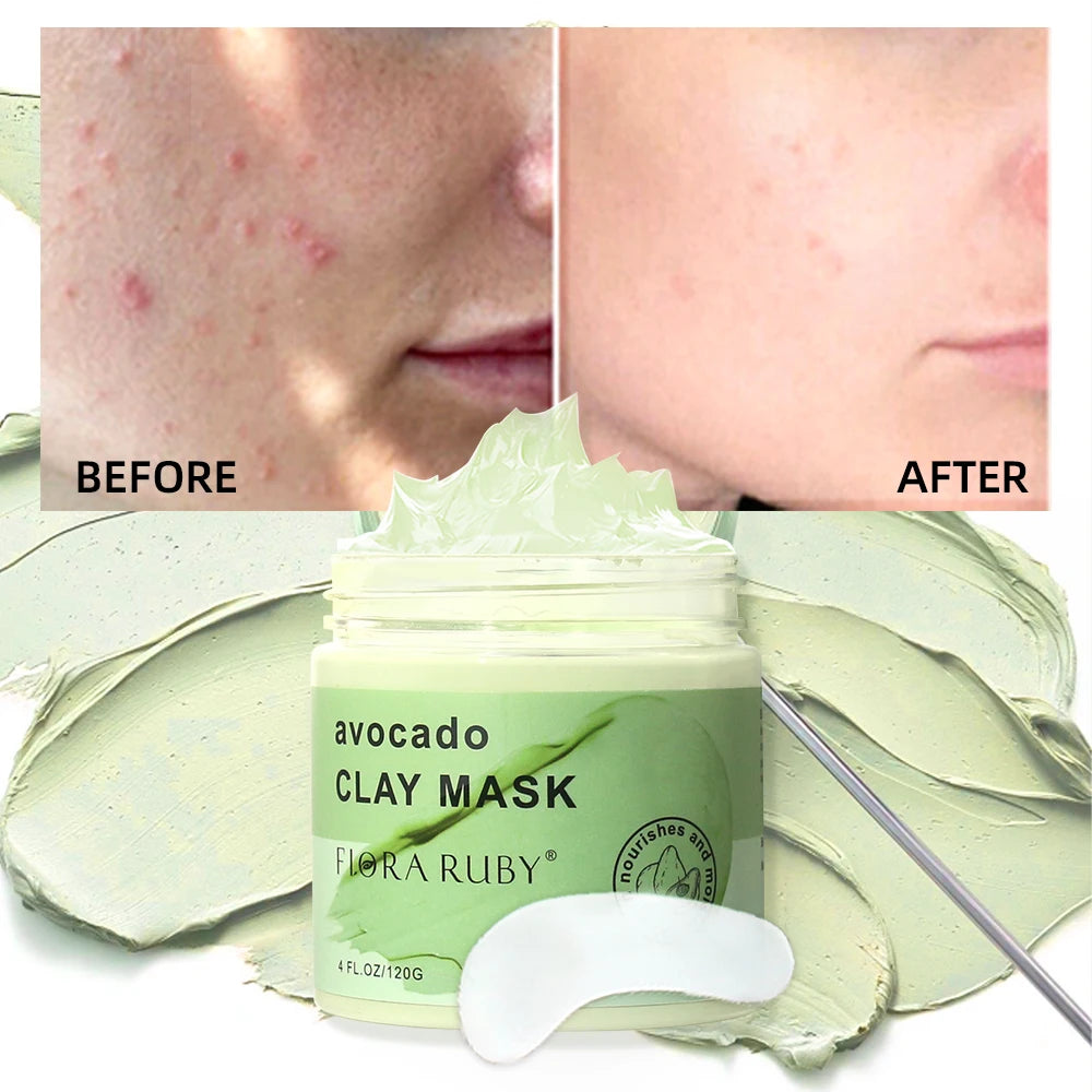 Face Masks Skincare-Avocado Clay Mask Moisturizing Mud Film Deep Pore