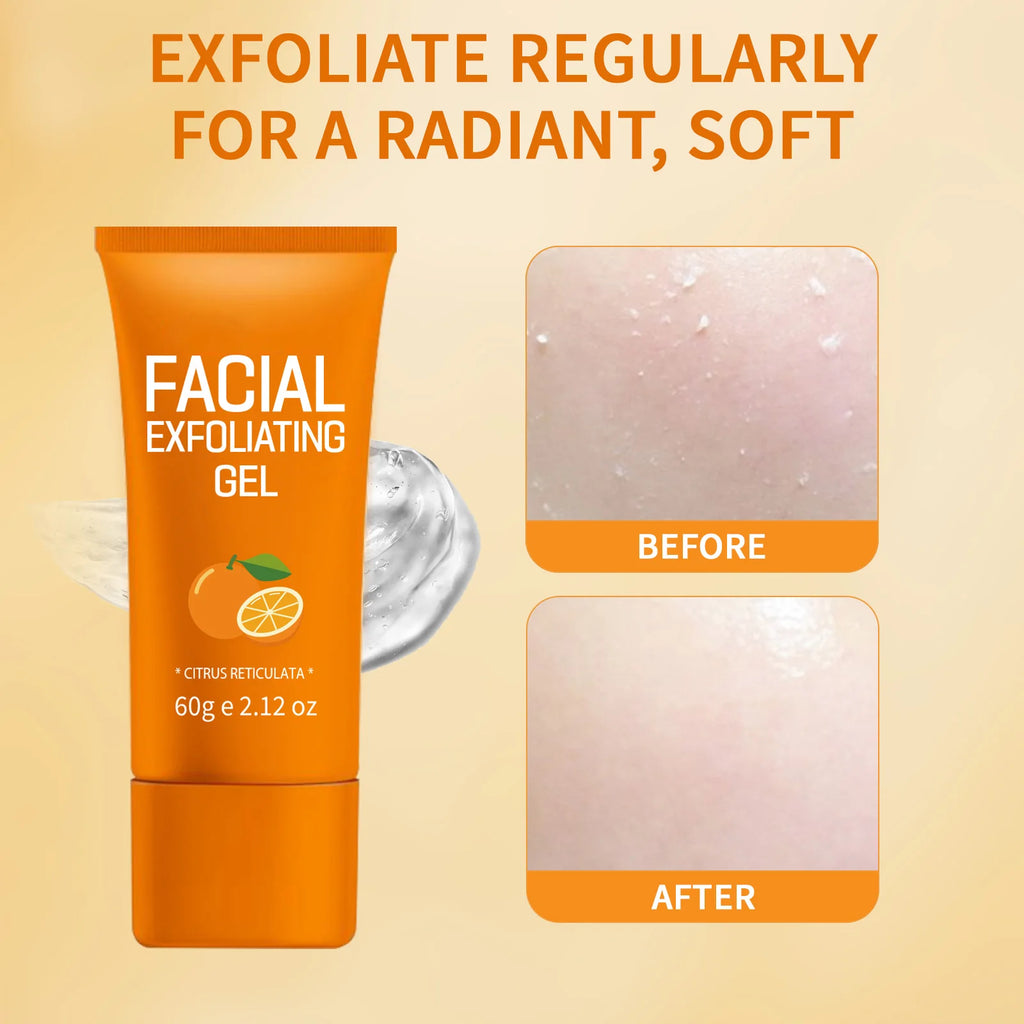 60g Orange Exfoliating Gel Dead Spot Remover Brighten Peeling Gentle