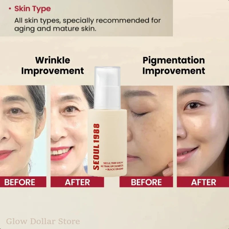 Korean Skincare SEOUL 1988 Serum Retinol Essence Vitamin C Anti