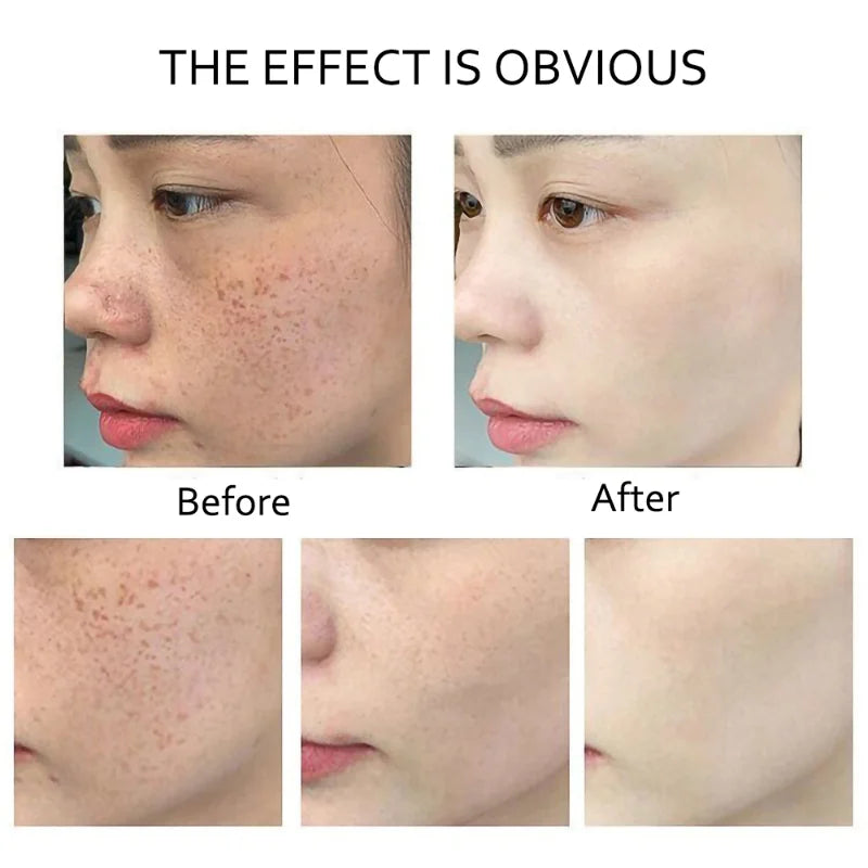 Retinol Serum Anti Wrinkle Fade Dark Spots Vitamin C Facial Serum