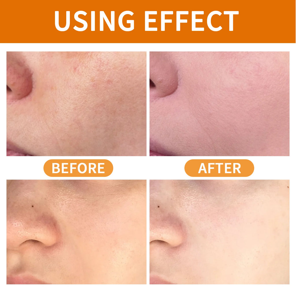 60g Orange Exfoliating Gel Dead Spot Remover Brighten Peeling Gentle