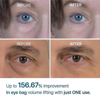 Dr. Melaxin Eyephalt Eye Cream