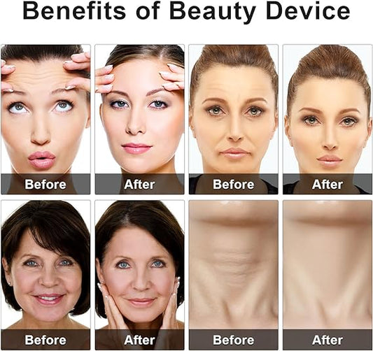 Elysse LiftGlow™ – 4-in-1 Microcurrent Skin Tightening image 2
