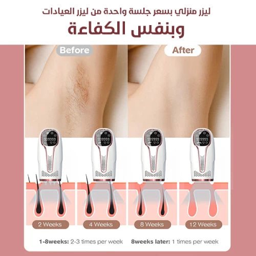 Elysse IceGlow IPL™ Hair Removal Device image 2