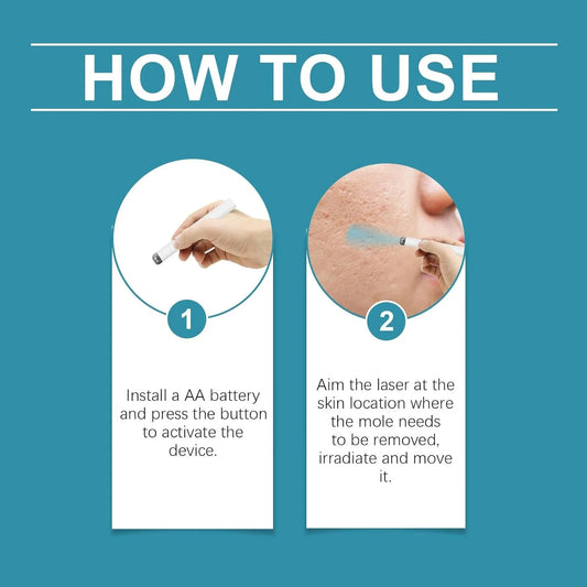 Xorita Non-Invasive Mole and Wart Removal Pen image 3